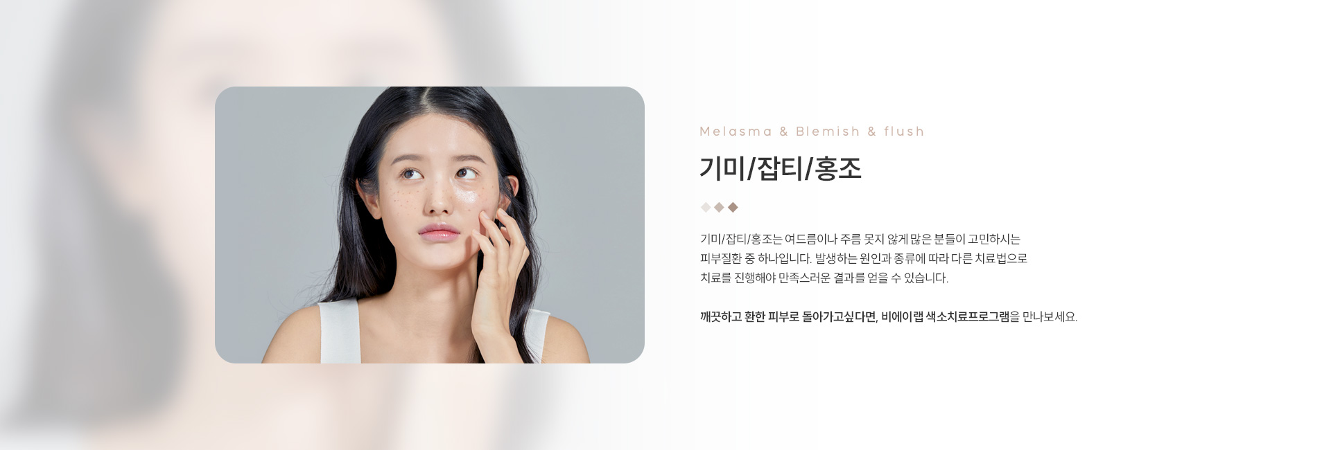 기미/잡티/홍조 01