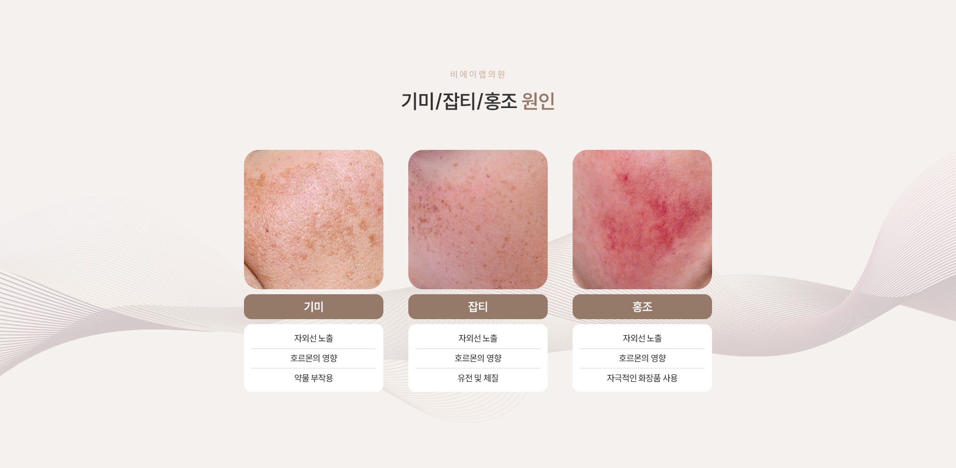 기미/잡티/홍조 03