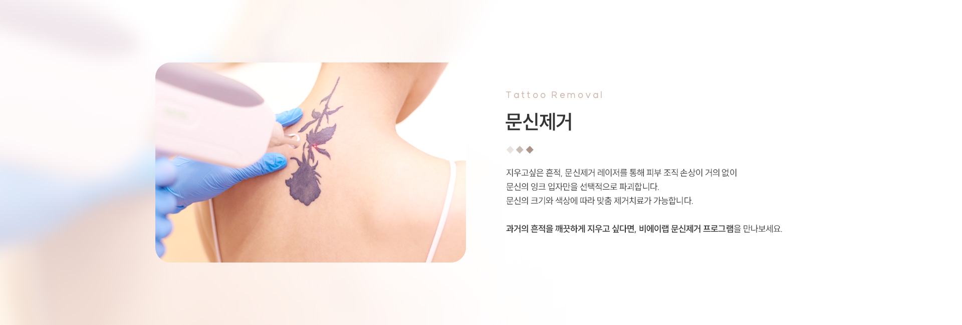 점/문신제거 05