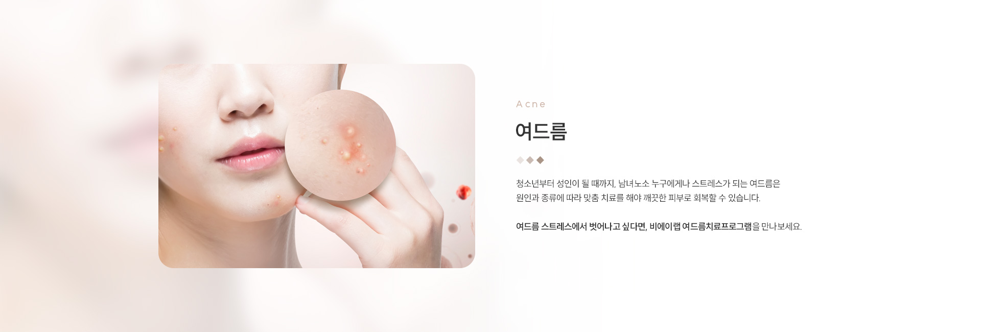 여드름/모공/흉터 01