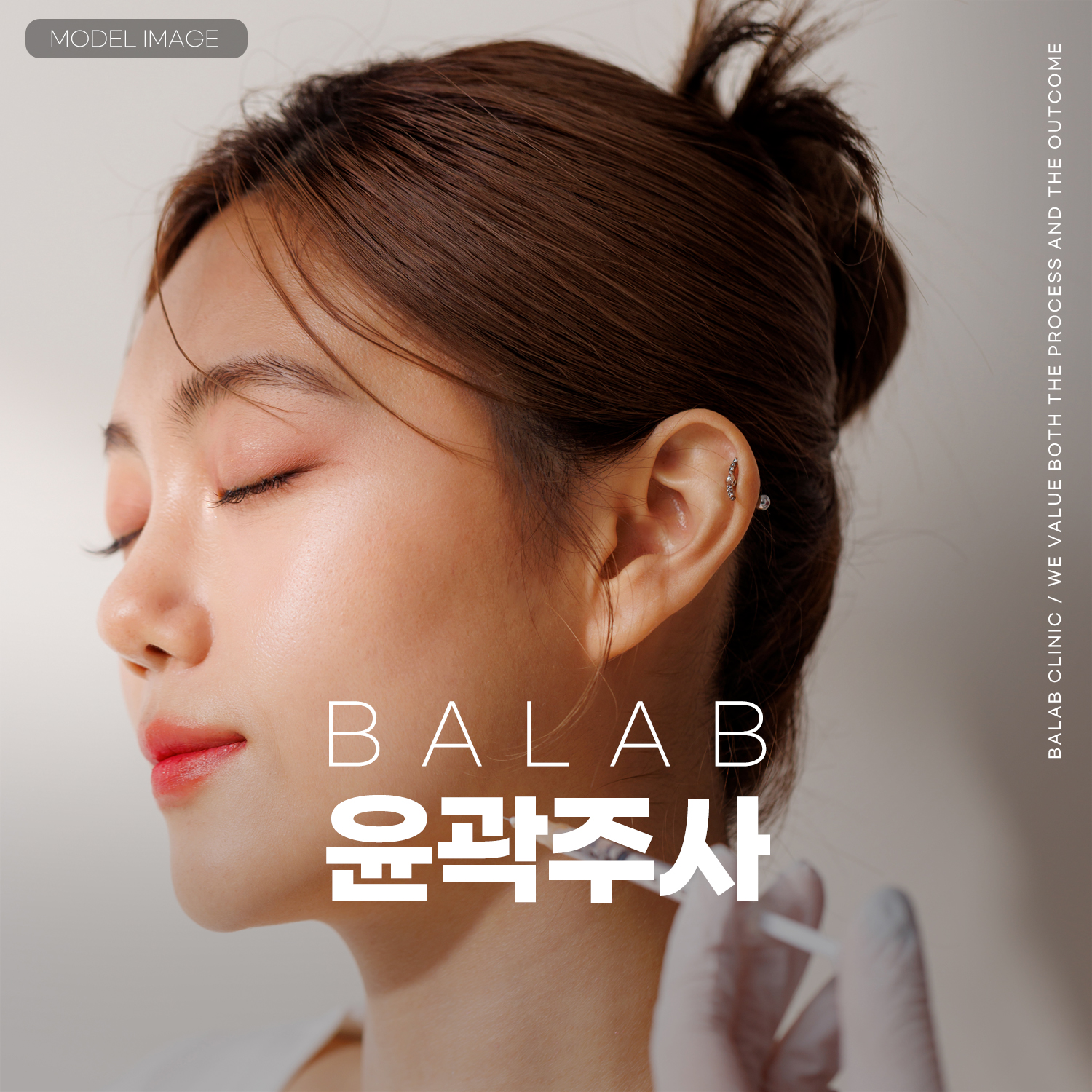 윤곽주사