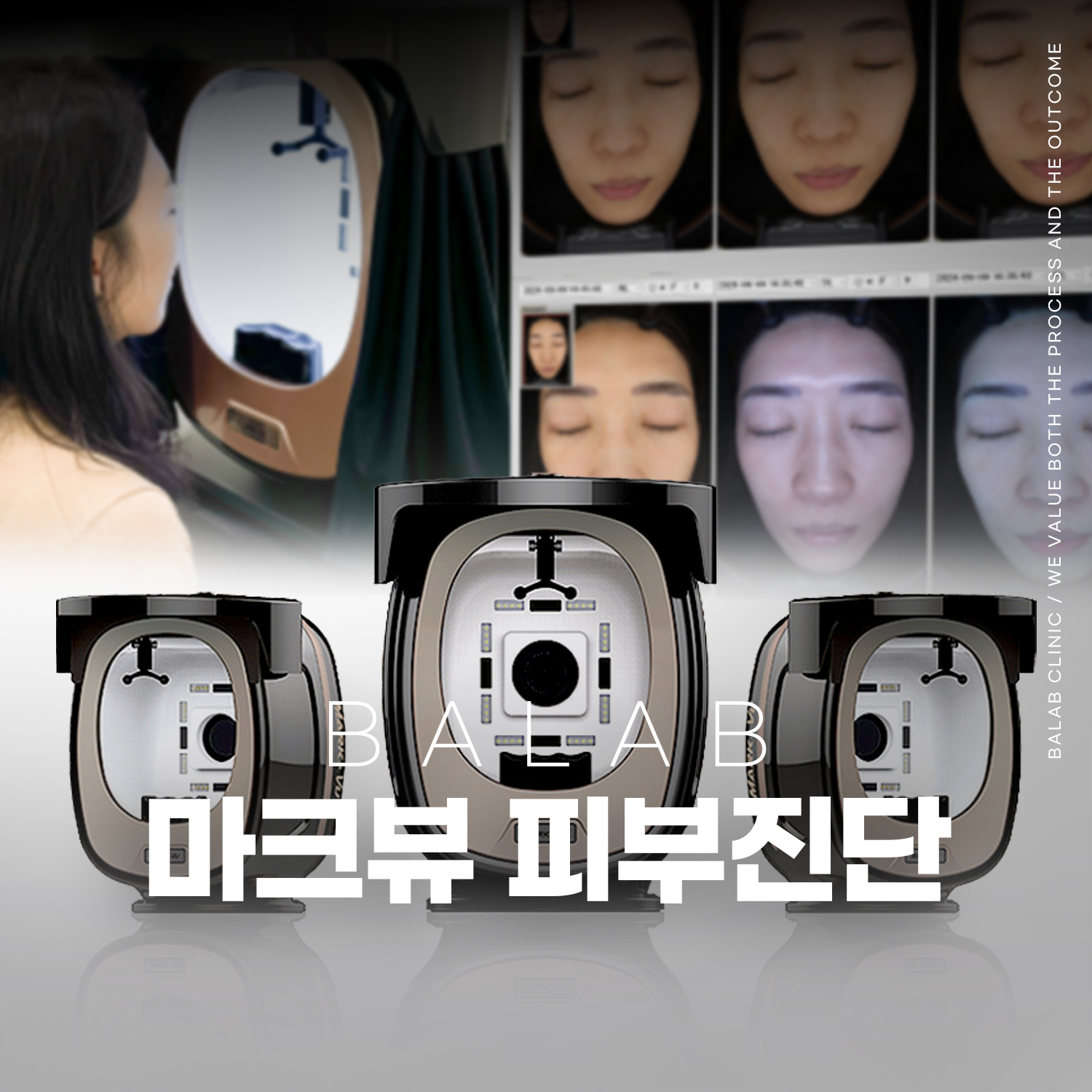 피부진단 컨설팅