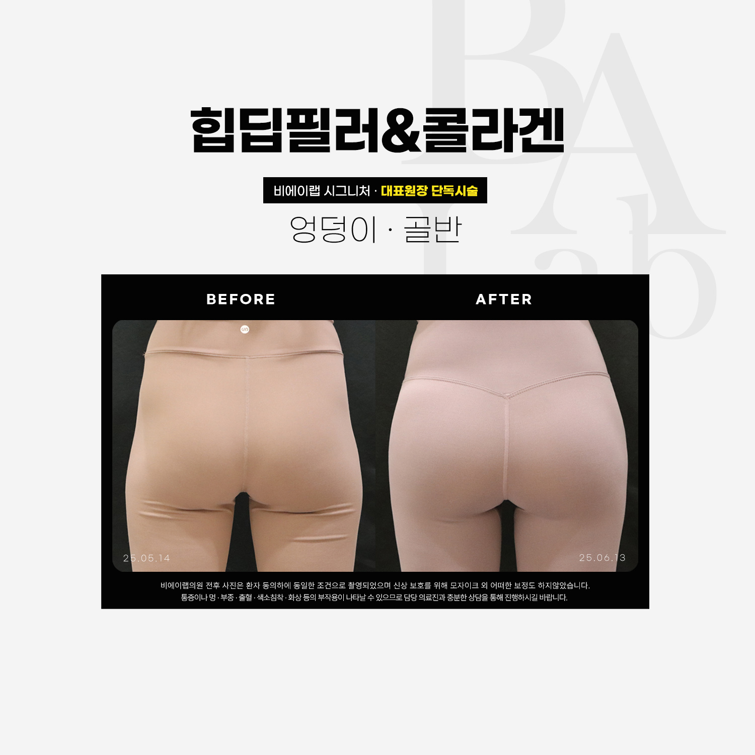 내기 원하던 힙&골반 라인으로🩷
